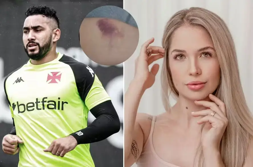Larissa Ferrari acusa Dimitri Payet, do Vasco, de agressão