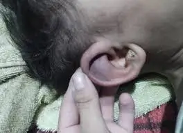 Agressão a bebe de 4 anos