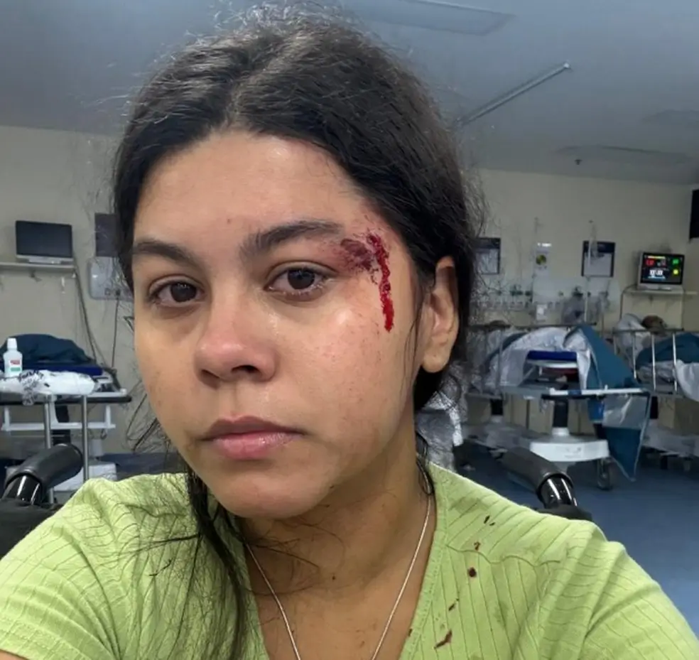 Nathalia em foto tirada no hospital após as agressões do ex-namorado