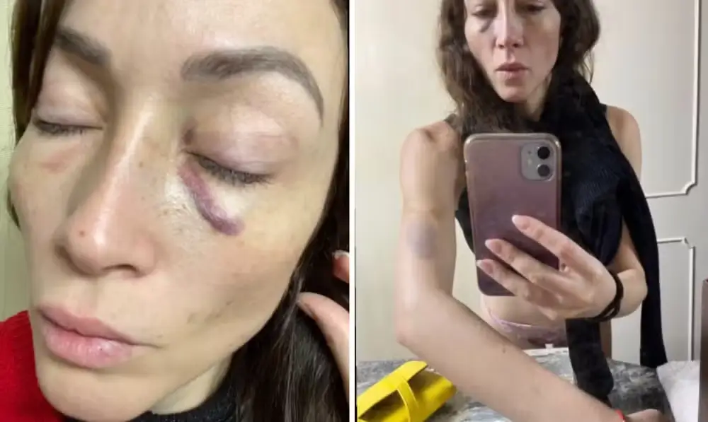 Laura Vignatti foi agredida por Salvador Zubirán Rabay