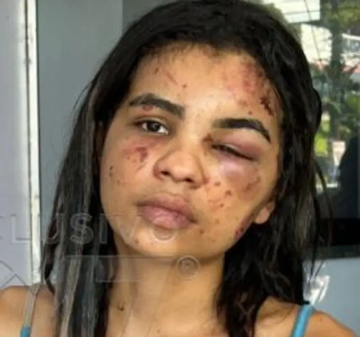 jovem é brutalmente agredida no Japiim