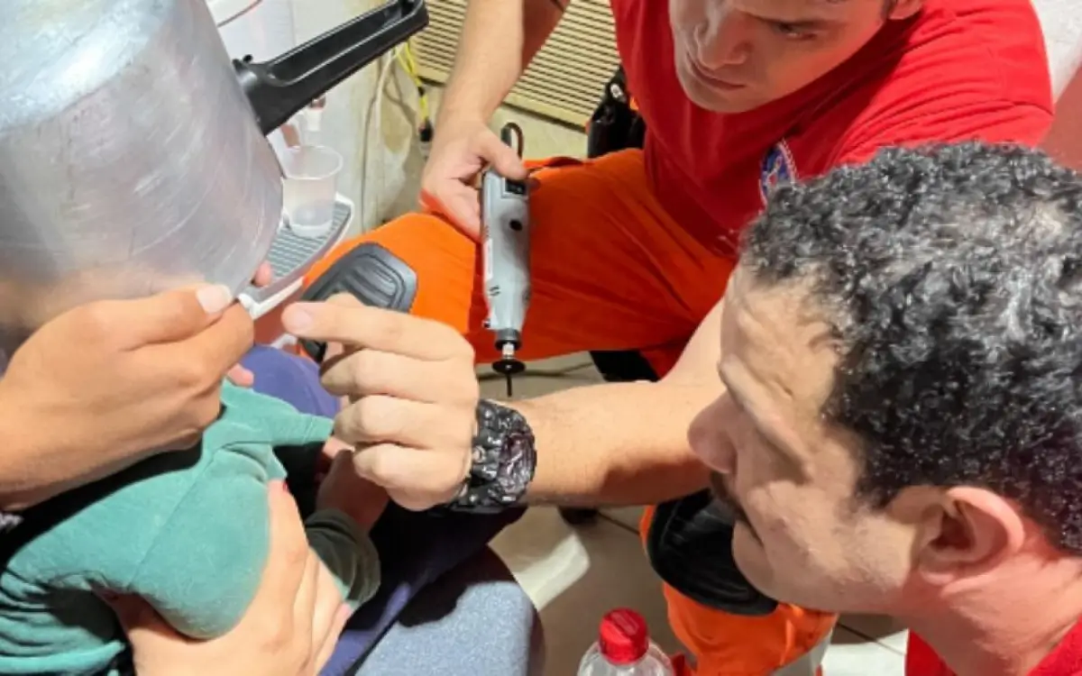 menino fica com cabeça presa em panela de pressão