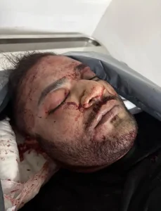 Fhillip da Silva Gregório Morto