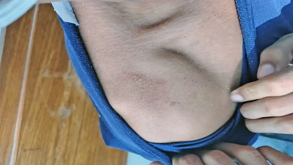 Marcas da Agressão