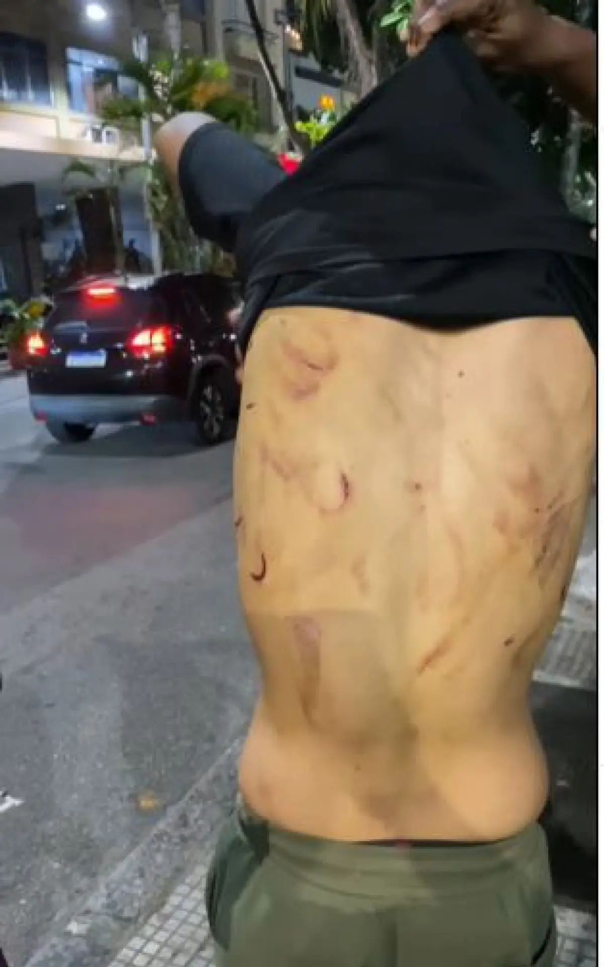 Entregador tem diversas marcas de agressões pelo corpo