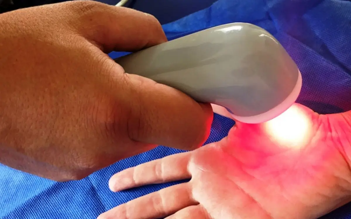 núcleo de fibromialgia em Macaé
