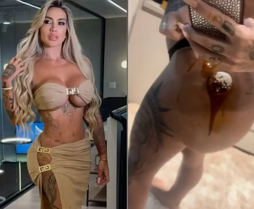 Juju Ferrari mostra hidrogel vazando do bumbum