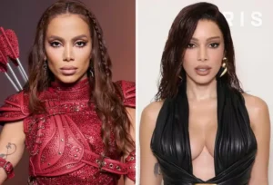 Antes e Depois de Anitta