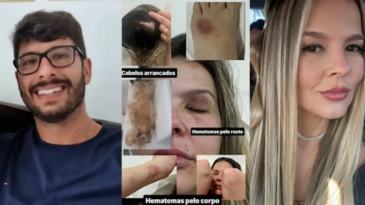 Após ser espancada pelo noivo, mulher obtém medida protetiva em São Pedro da Aldeia
