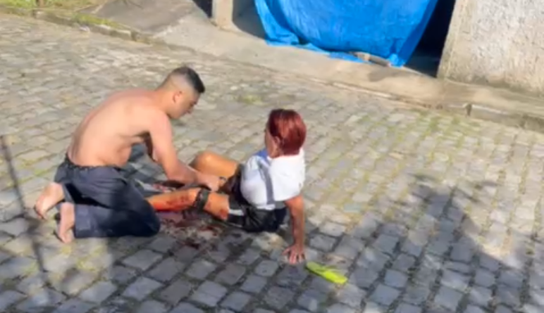 ataque de pitbull em São Pedro da Aldeia