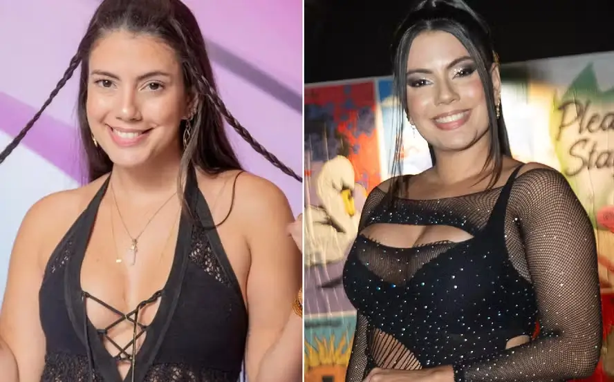 Fernanda Bande aumenta tamanho das próteses de silicone