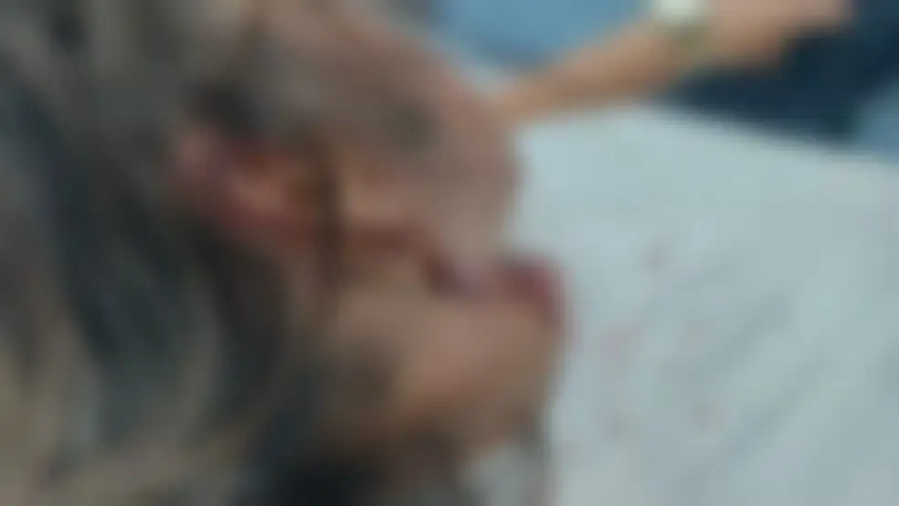 mulher é atacada por pitbull