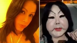 Antes e depois de Juju do Pix