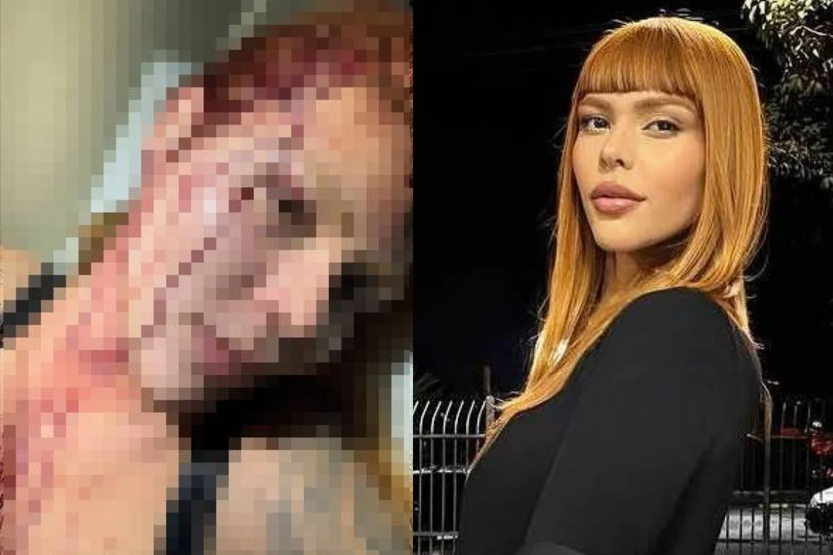 Modelo trans atacada por quatro vizinhos