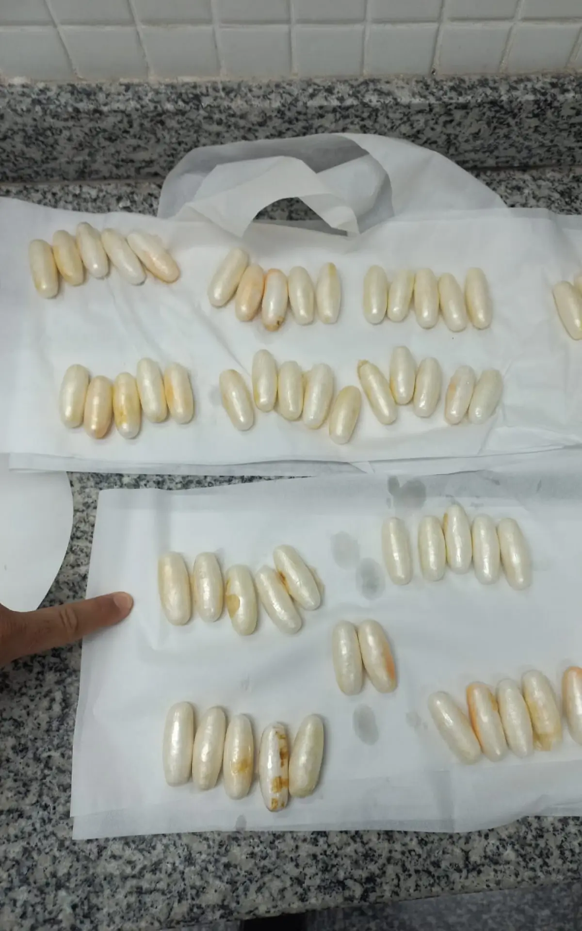 Suspeito já conseguiu expelir 57 cápsulas das 80 que ingeriu