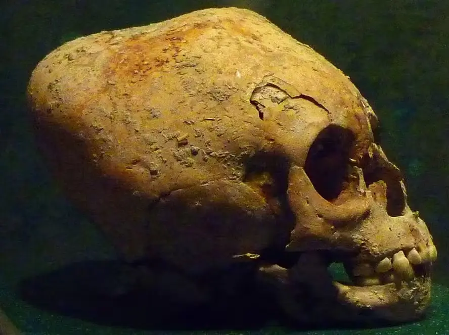 Identificada em crânio quadrado no México
