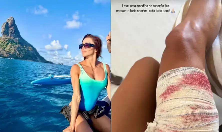 turista mordida por tubarão em Fernando de Noronha