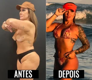 Vivi Fernandez antes e depois do corpo