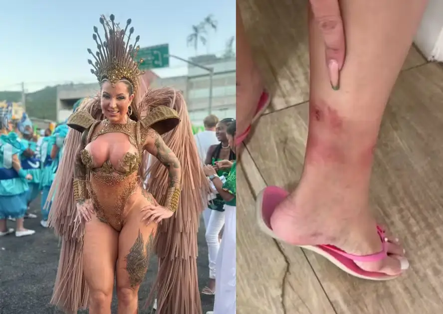 Elisa Sanches exibe machucados