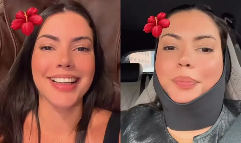 Fernanda Bande passa por redução de papada