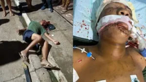 ataque de pitbull em São José dos Campos