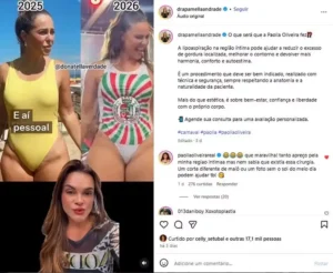 Paolla Oliveira rebate cirurgiã plástica após boatos sobre cirurgia íntima