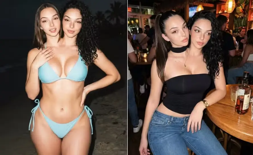supostas gêmeas siamesas Camila e Valeria