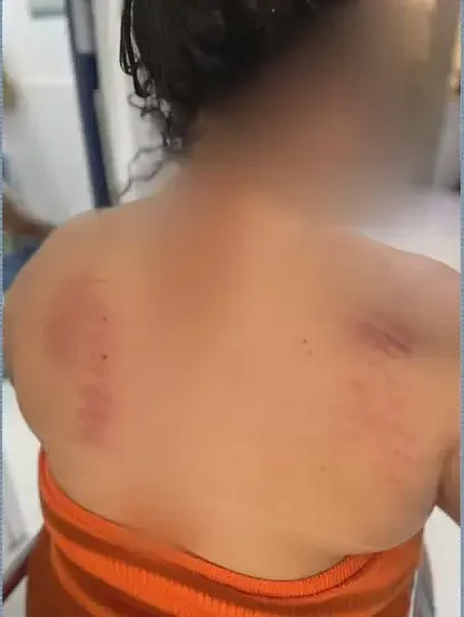 Agressão em São Gonçalo