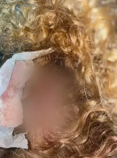 Mulher agredida após recusar cantada no Rio