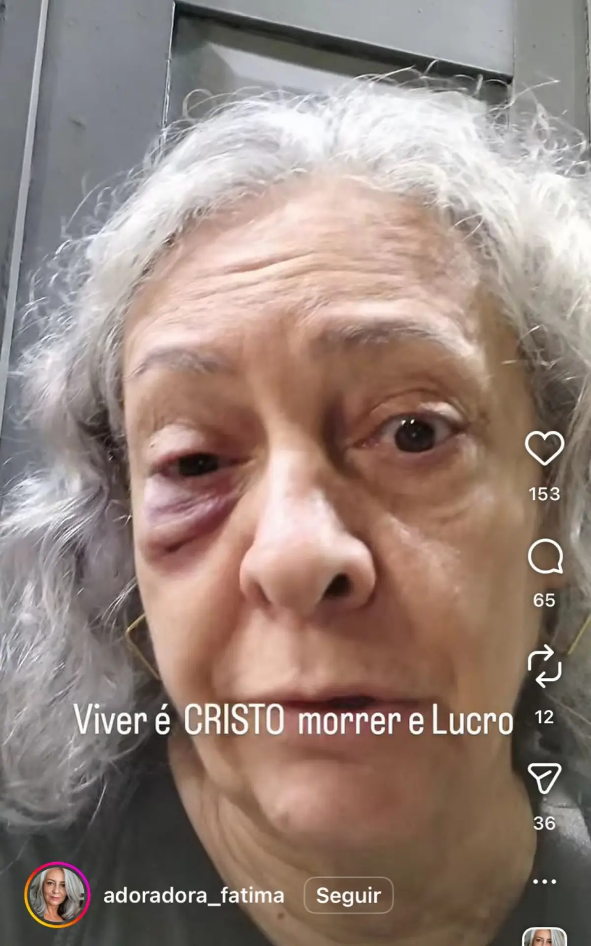 mulher agredida no Catete