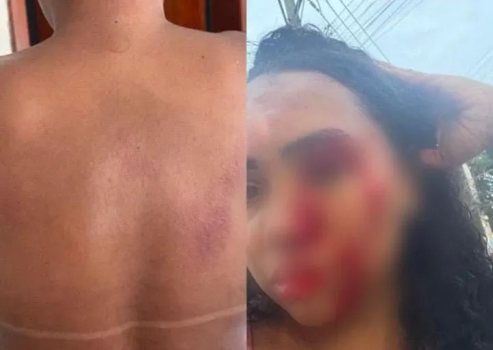 mulher agredida em Cosmos