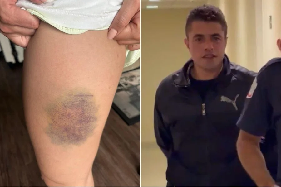 Nutricionista evita estupro usando defesa pessoal contra invasor