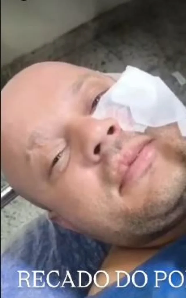 PM baleado no rosto tem quadro de saúde estável