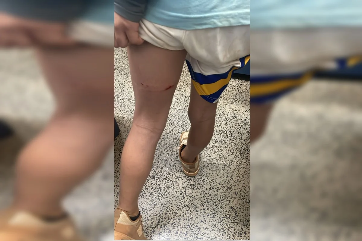Mãe aciona a Polícia após filho de 11 anos ser supostamente agredido por professora em escola pública