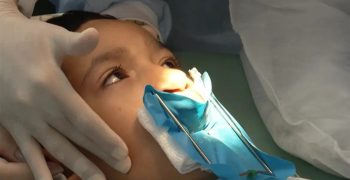 alerj-aprova-lei-tratamento-fissura-labiopalatal-sus-rio-fonte0